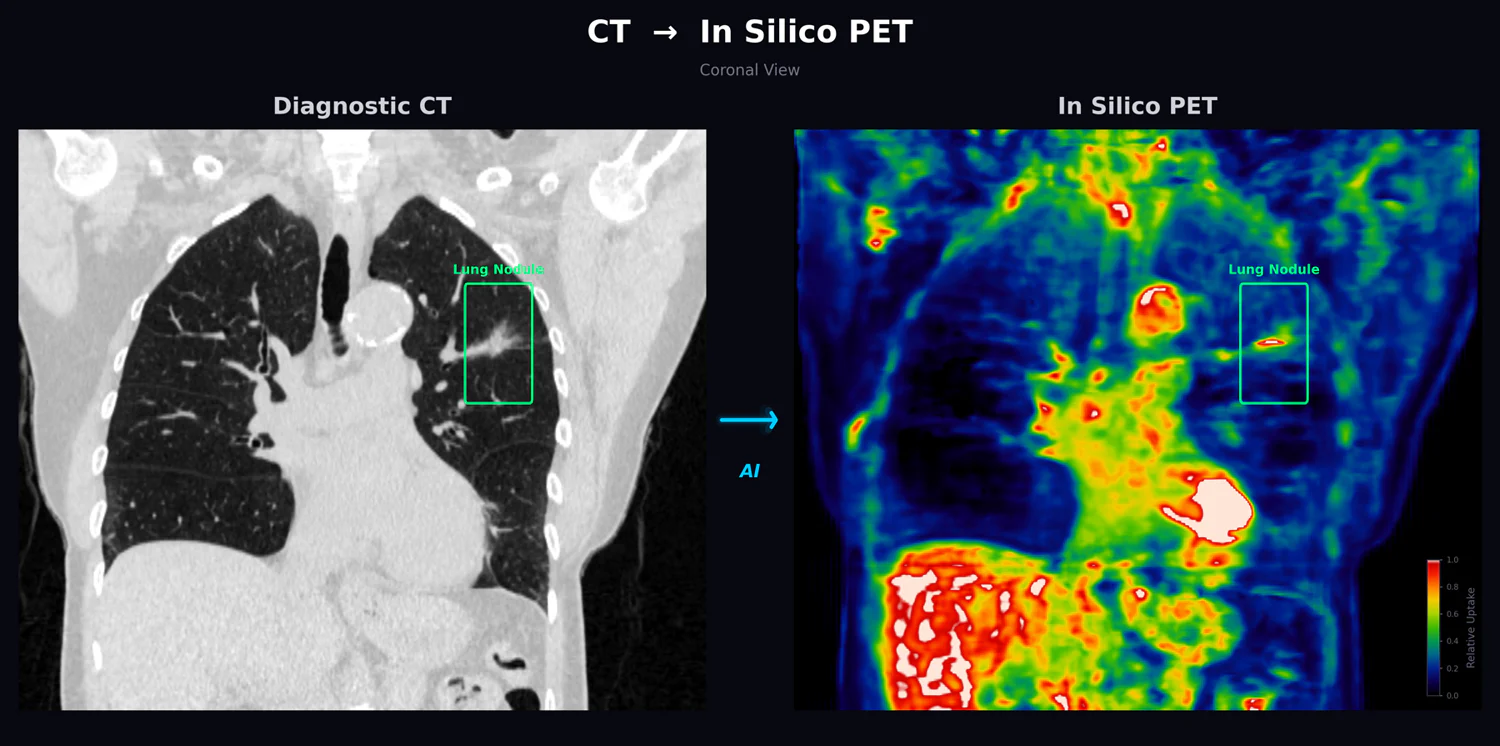 A diagnostic CT scan beside a generated in silico PET scan, both showing the same boxed lung nodule