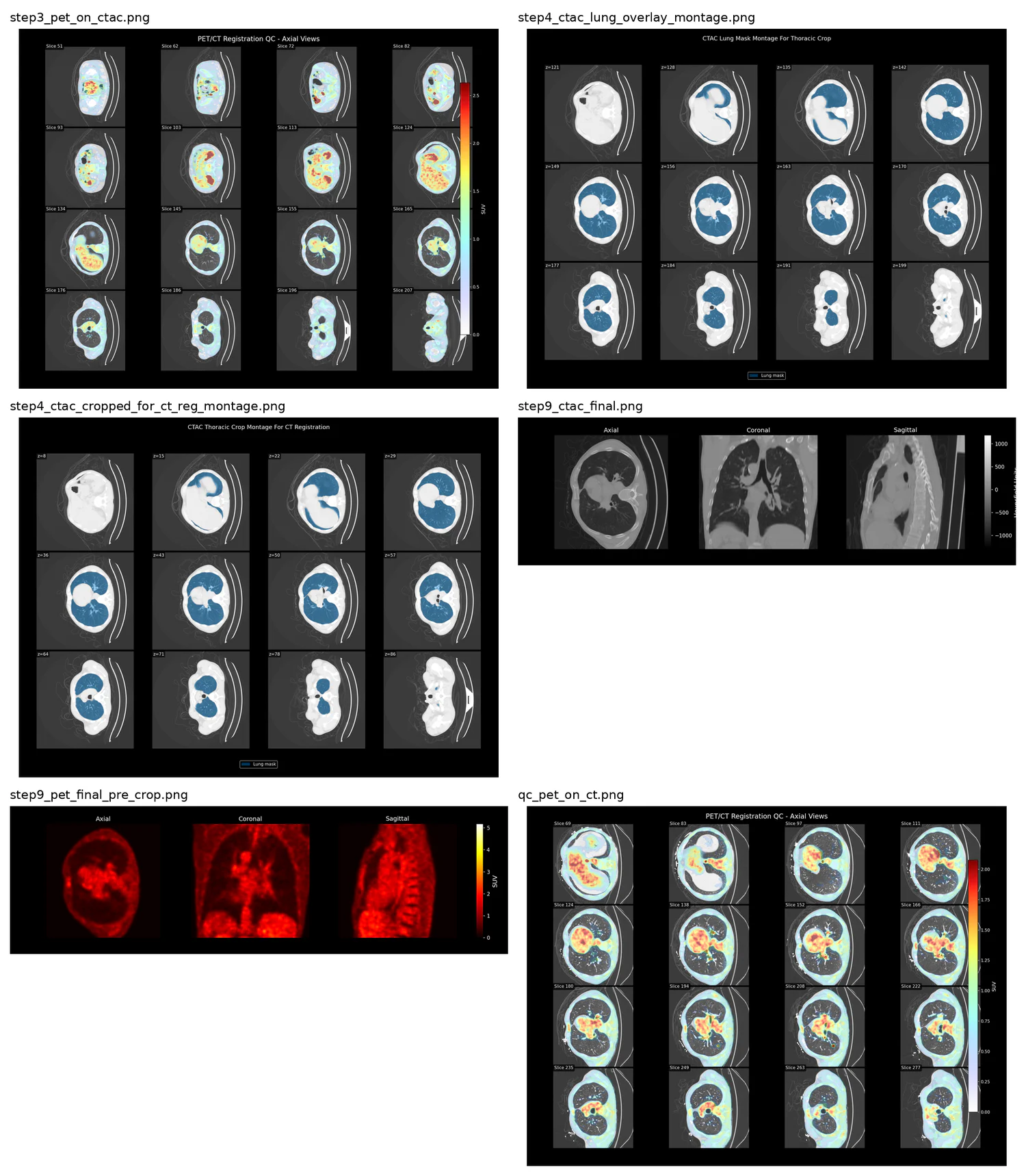 Contact sheet of quality control montages: PET on CTAC, lung mask overlays, thoracic crop montages, and final axial, coronal and sagittal views