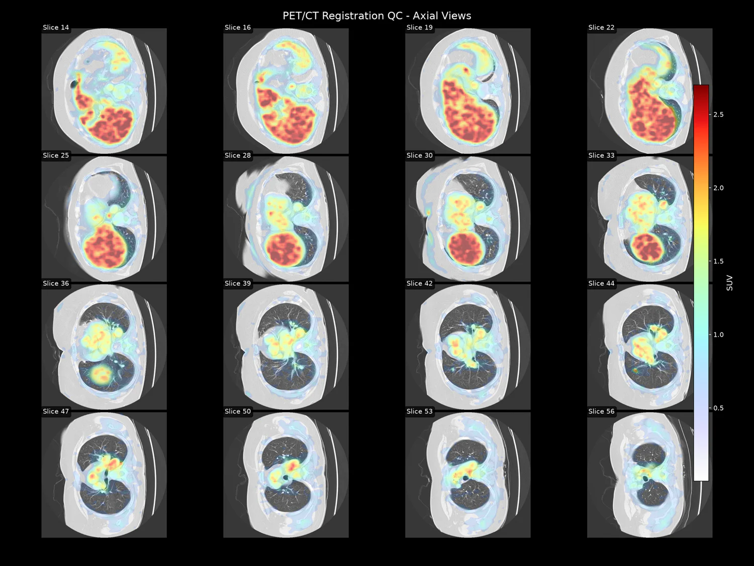 Grid of axial slices with PET overlaid in colour on greyscale CT, used as a registration quality control sheet